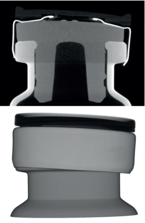 Application of Computed Tomography for In-Depth Investigation of Freeze-Dried Products